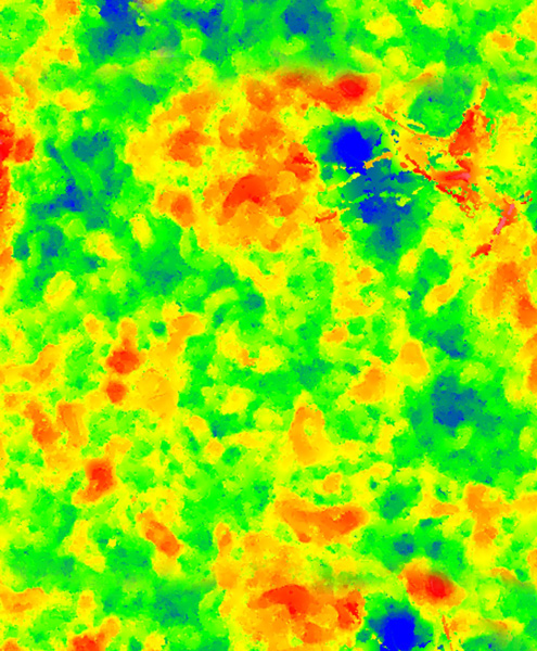 Topography implant: Laser-Scanning-Microscopy (3A).