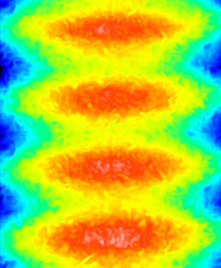 Topography implant: White-Light-Interferometry (3B).
