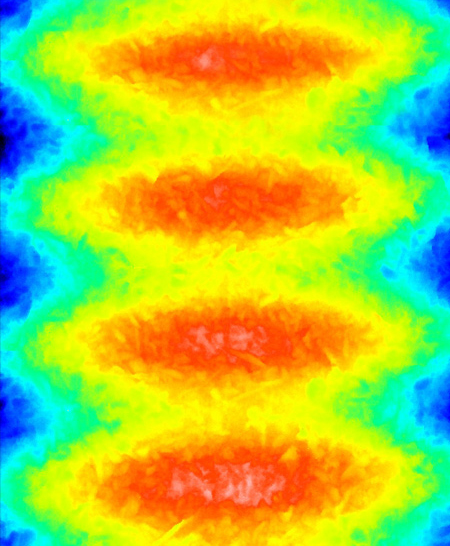 Topography implant: White-Light-Interferometry (3B).